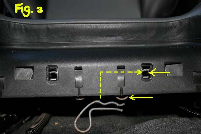 Thigh Bolster clip insertion