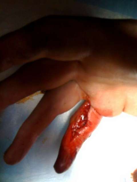 finger